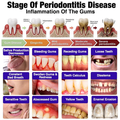 🦷Whimsyandjoy Bee Venom Gingivitis & Periodontitis Treatment Toothpaste