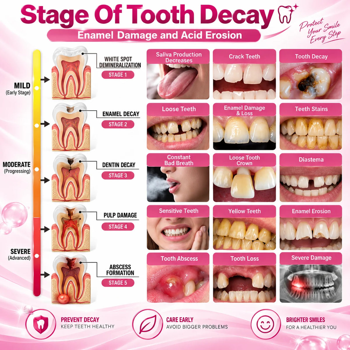 AQA® 🏆DenPerm Cavity-Repair Natural Enamel Filling Gel