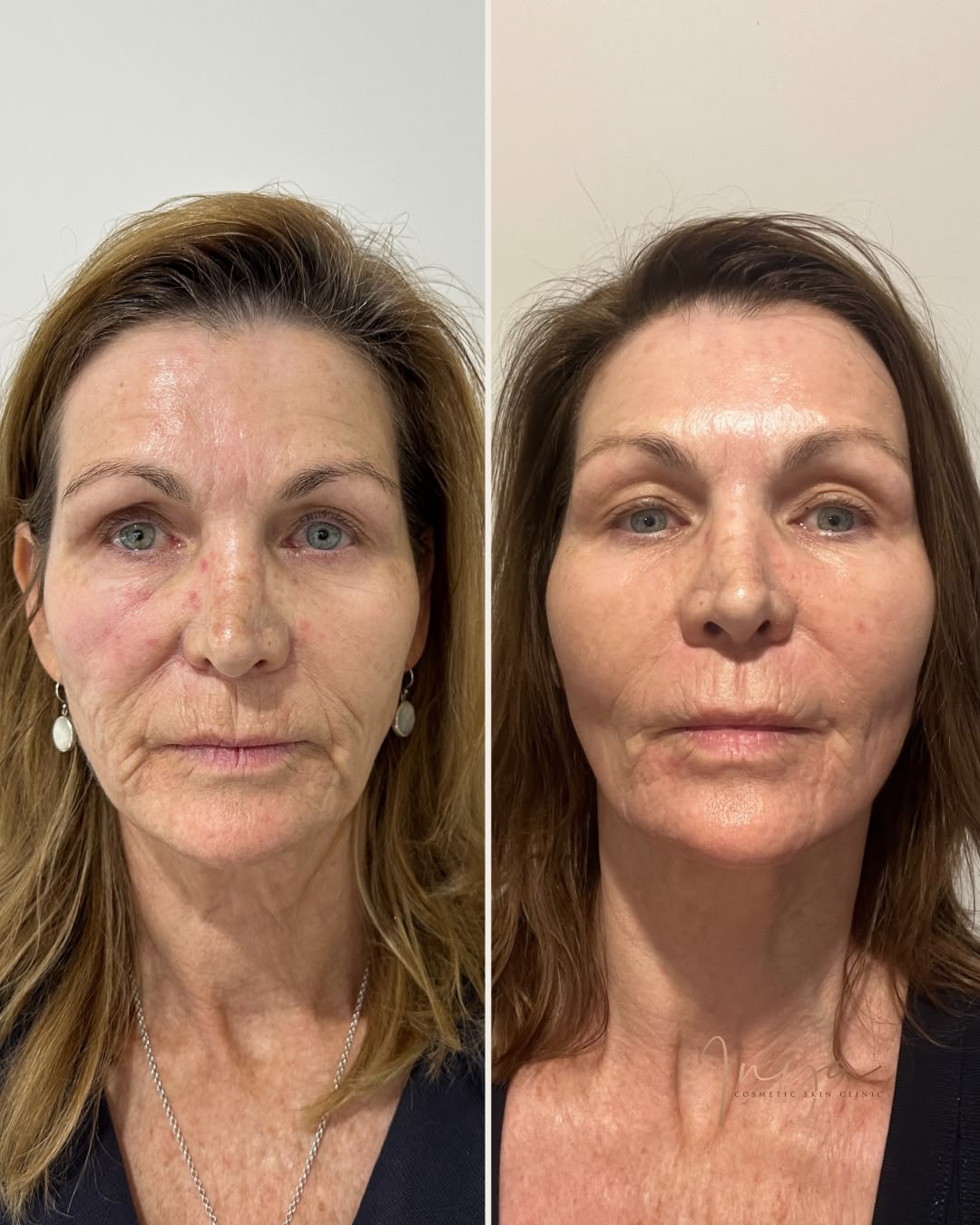 ✨Neslemy Firming & Anti-Aging Facial Serum
