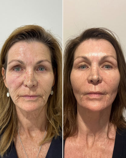 ✨Neslemy Firming & Anti-Aging Facial Serum
