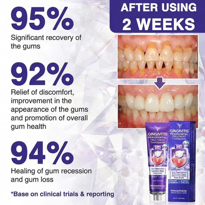 🦷Whimsyandjoy Bee Venom Gingivitis & Periodontitis Treatment Toothpaste