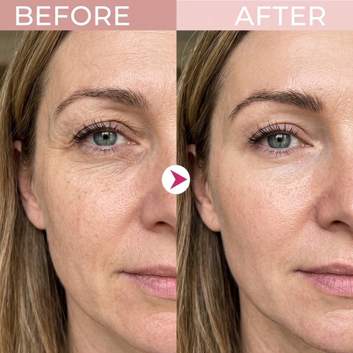 🌸LAST DAY: BUY 1 GET 1 FREE❤️P7 Eye Renewal Cream