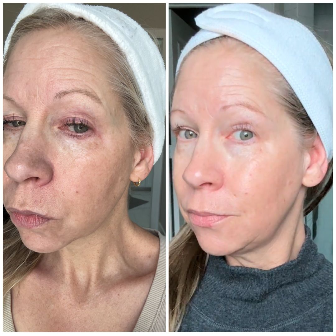 ✨Neslemy Firming & Anti-Aging Facial Serum