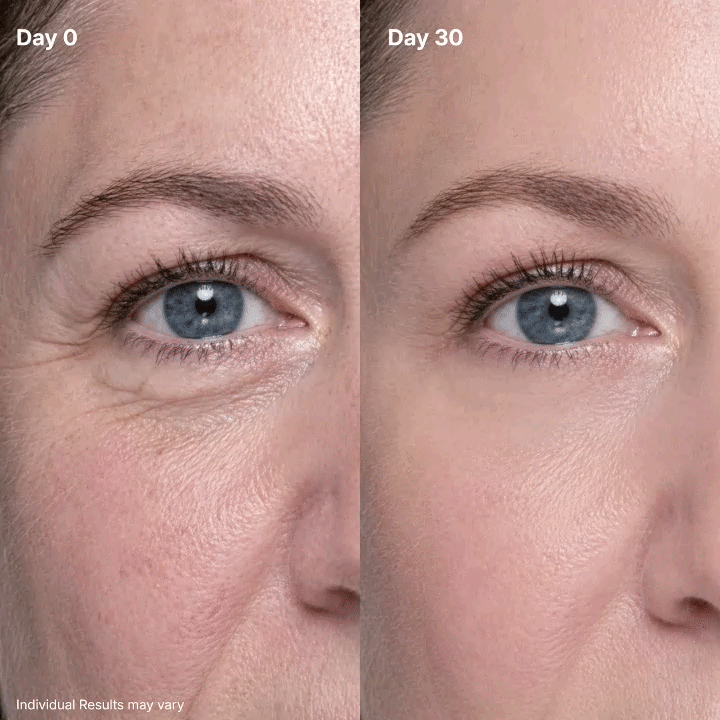 🌸LAST DAY: BUY 1 GET 1 FREE❤️P7 Eye Renewal Cream